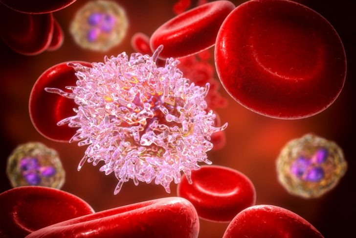 leukemia-cells