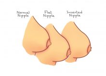 The Different Shapes Of A Normal Woman's Nipple.